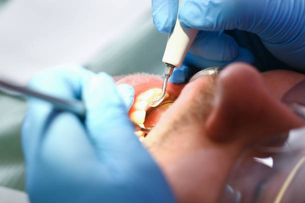 Best Emergency Dental Filling Replacement  in Long Beach, CA
