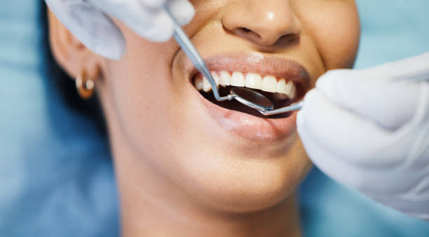 Best Dentist for Tooth Abscess  in Long Beach, CA